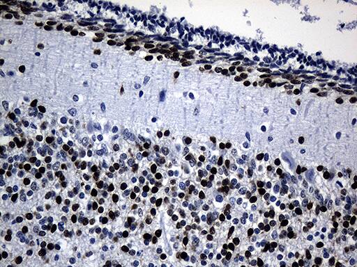 Immunohistochemical staining of paraffin-embedded Human embryonic cerebellum within the normal limits using anti-PHF20L1 mouse monoclonal antibody. Heat-induced epitope retrieval by EDTA solution buffer pH 8.0 at 120Â°C for 3 min.