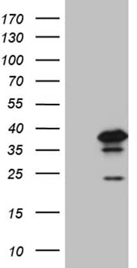 HEK293T cells were transfected with the pCMV6-ENTRY control (Left lane) or pCMV6-ENTRY PHF20L1 (, Right lane) cDNA for 48 hrs and lysed. Equivalent amounts of cell lysates (5 ug per lane) were separated by SDS-PAGE and immunoblotted with anti-PHF20L1 (1:2000). 