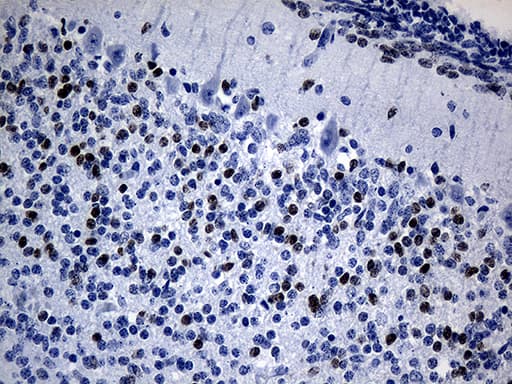 Immunohistochemistry:PHF20L1 Antibody (OTI1F4)[NBP3-45021]