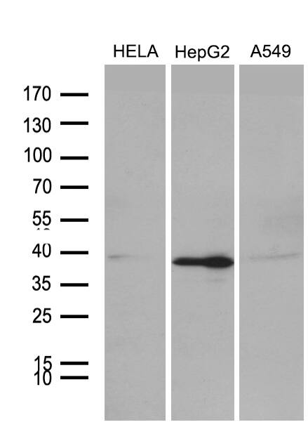 Western blot analysis of extracts (35ug) from 3 different cell lines by using anti-PHF20L1 monoclonal antibody (1:500).