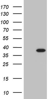 HEK293T cells were transfected with the pCMV6-ENTRY control ( Left lane) or pCMV6-ENTRY PHF20L1 ( Right lane) cDNA for 48 hrs and lysed. Equivalent amounts of cell lysates (5 ug per lane) were separated by SDS-PAGE and immunoblotted with anti-PHF20L1 (1:2000). Positive lysates
