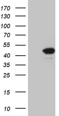 HEK293T cells were transfected with the pCMV6-ENTRY control ( Left lane) or pCMV6-ENTRY FBXO22 ( Right lane) cDNA for 48 hrs and lysed. Equivalent amounts of cell lysates (5 ug per lane) were separated by SDS-PAGE and immunoblotted with anti-FBXO22 (1:2000). Positive lysates