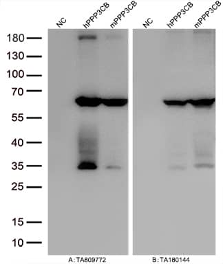 Western Blot:PPP3CB Antibody (OTI2E4)[NBP3-45023]