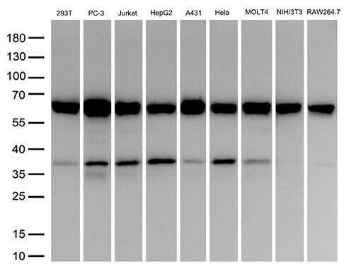 Western Blot:PPP3CB Antibody (OTI2E4)[NBP3-45023]
