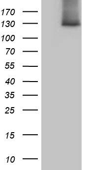 Western Blot SUPT16H Antibody (OTI8A1)