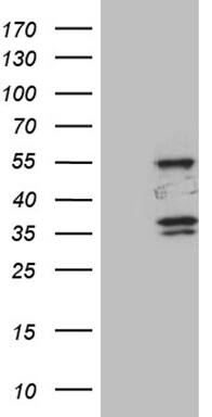 HEK293T cells were transfected with the pCMV6-ENTRY control ( Left lane) or pCMV6-ENTRY SPAG4 ( Right lane) cDNA for 48 hrs and lysed. Equivalent amounts of cell lysates (5 ug per lane) were separated by SDS-PAGE and immunoblotted with anti-SPAG4 (1:500). Positive lysates