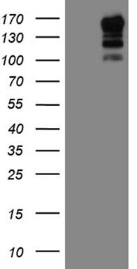 HEK293T cells were transfected with the pCMV6-ENTRY control (Left lane) or pCMV6-ENTRY USP40 (, Right lane) cDNA for 48 hrs and lysed. Equivalent amounts of cell lysates (5 ug per lane) were separated by SDS-PAGE and immunoblotted with anti-USP40 (1:2000). 