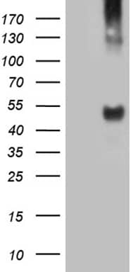 HEK293T cells were transfected with the pCMV6-ENTRY control ( Left lane) or pCMV6-ENTRY TAT ( Right lane) cDNA for 48 hrs and lysed. Equivalent amounts of cell lysates (5 ug per lane) were separated by SDS-PAGE and immunoblotted with anti-TAT (1:2000). Positive lysates