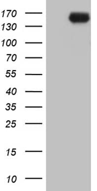 HEK293T cells were transfected with the pCMV6-ENTRY control ( Left lane) or pCMV6-ENTRY INPP5F ( Right lane) cDNA for 48 hrs and lysed. Equivalent amounts of cell lysates (5 ug per lane) were separated by SDS-PAGE and immunoblotted with anti-INPP5F (1:2000). Positive lysates