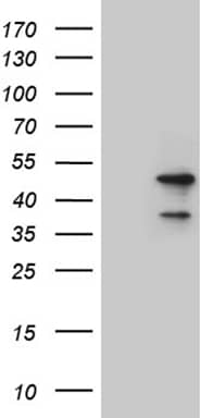 Western Blot LSM11 Antibody (OTI1H1)