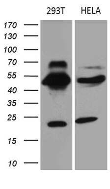 Western Blot TEKT2 Antibody (OTI1E6)