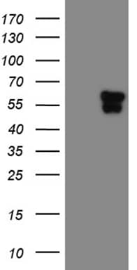 Western Blot TEKT2 Antibody (OTI1E11)
