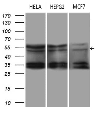 Western Blot DDX19A Antibody (OTI3C12)