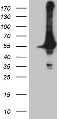 HEK293T cells were transfected with the pCMV6-ENTRY control ( Left lane) or pCMV6-ENTRY DDX19A ( Right lane) cDNA for 48 hrs and lysed. Equivalent amounts of cell lysates (5 ug per lane) were separated by SDS-PAGE and immunoblotted with anti-DDX19A (1:2000). Positive lysates