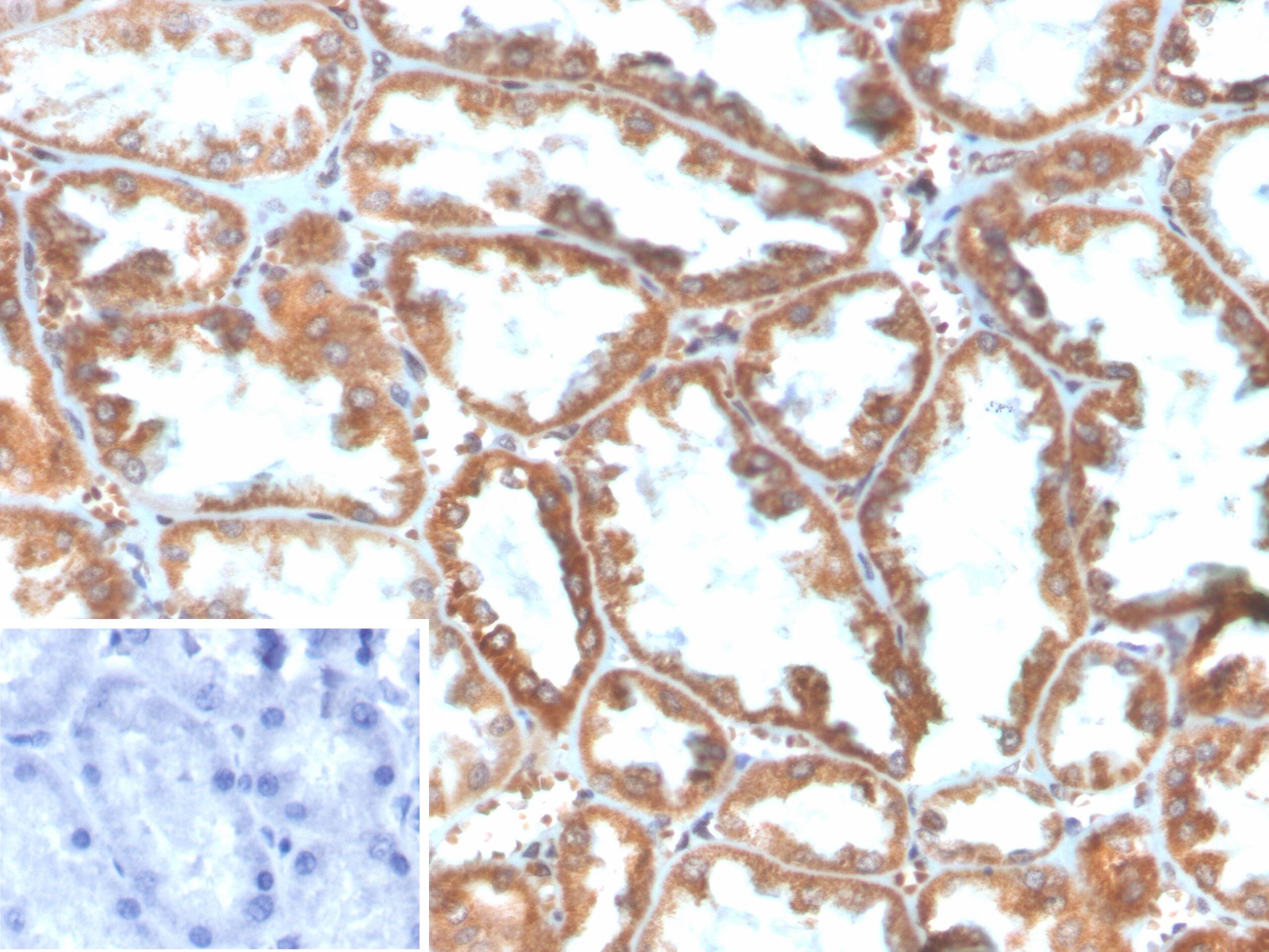 Formalin-fixed, paraffin-embedded human kidney stained with PLA2R1 Antibody (PLA2R1/4897) - Azide and BSA Free. Inset: PBS instead of primary antibody; secondary only negative control.