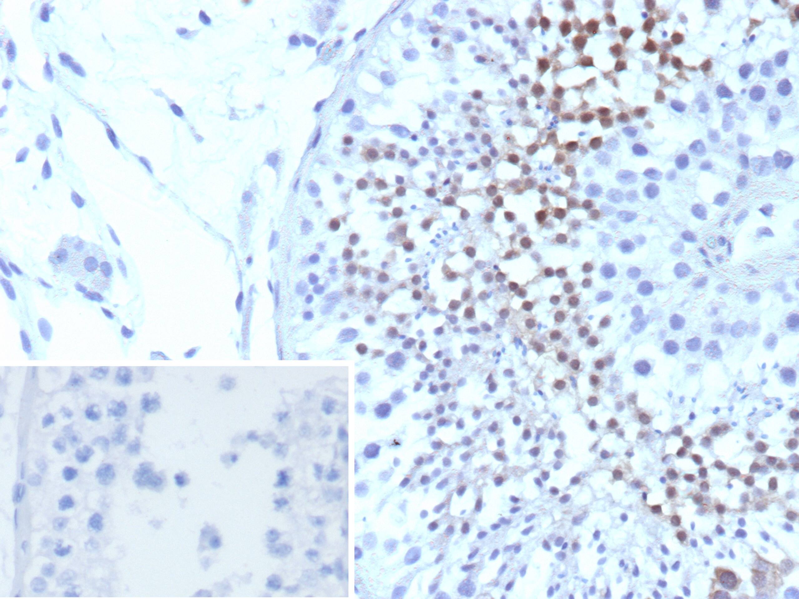 Formalin-fixed, paraffin-embedded human testis stained with Centrin 1 Antibody (CETN1/9880) - Azide and BSA Free. Inset: PBS instead of primary antibody; secondary only negative control.