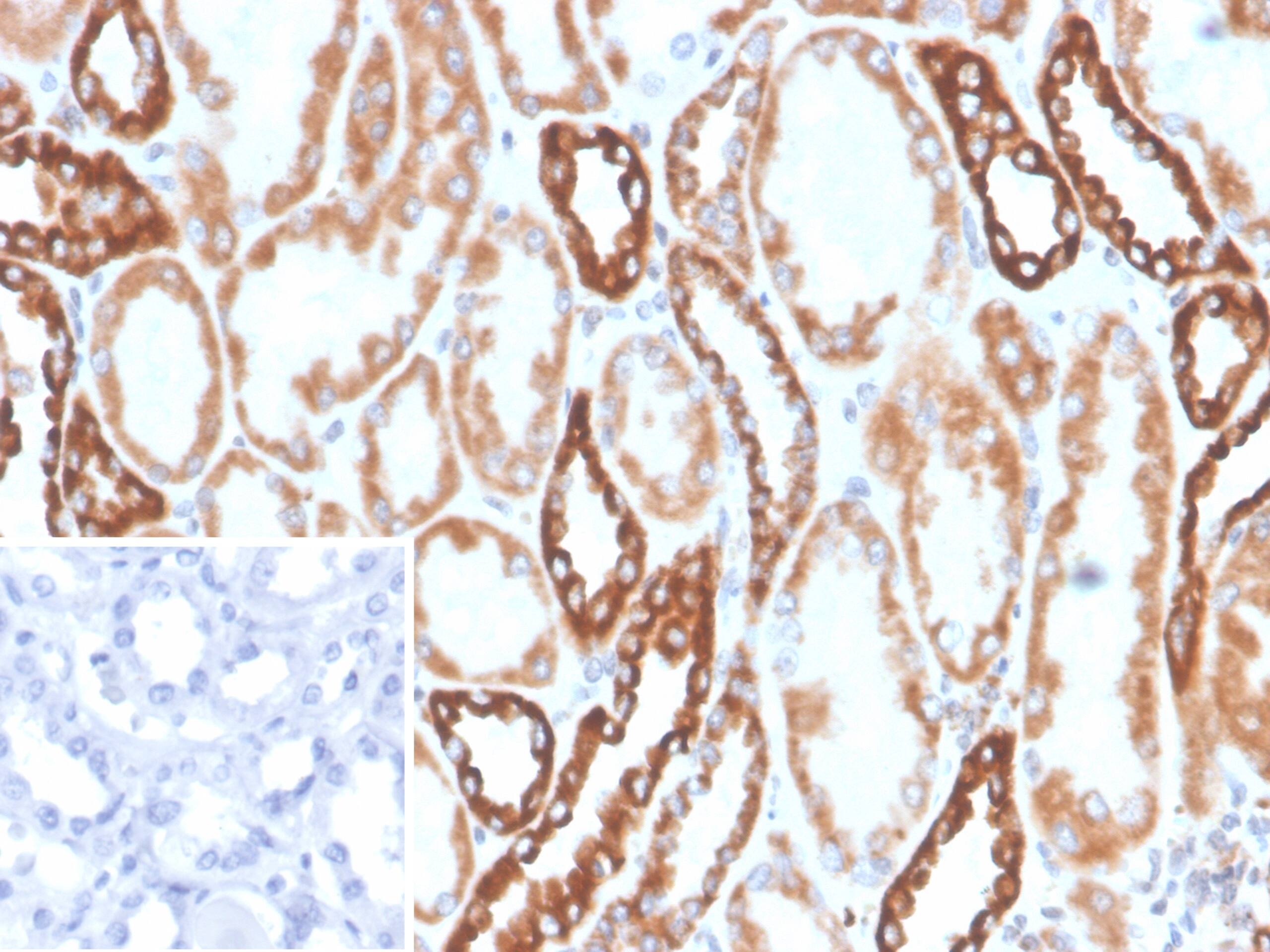 Formalin-fixed, paraffin-embedded human kidney stained with PLA2R1 Antibody (PLA2R1/4894) - Azide and BSA Free. Inset: PBS instead of primary antibody; secondary only negative control.