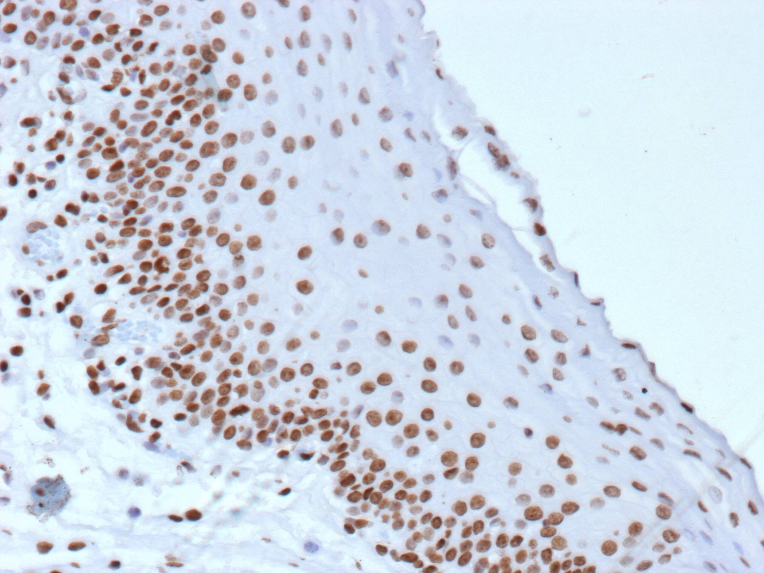 Formalin-fixed, paraffin-embedded human tonsil stained with Histone H3.1 [p Ser10] Antibody (rHH3/9924) - Azide and BSA Free. HIER: Tris/EDTA, pH9.0, 45min. 2 : HRP-polymer, 30min. DAB, 5min.