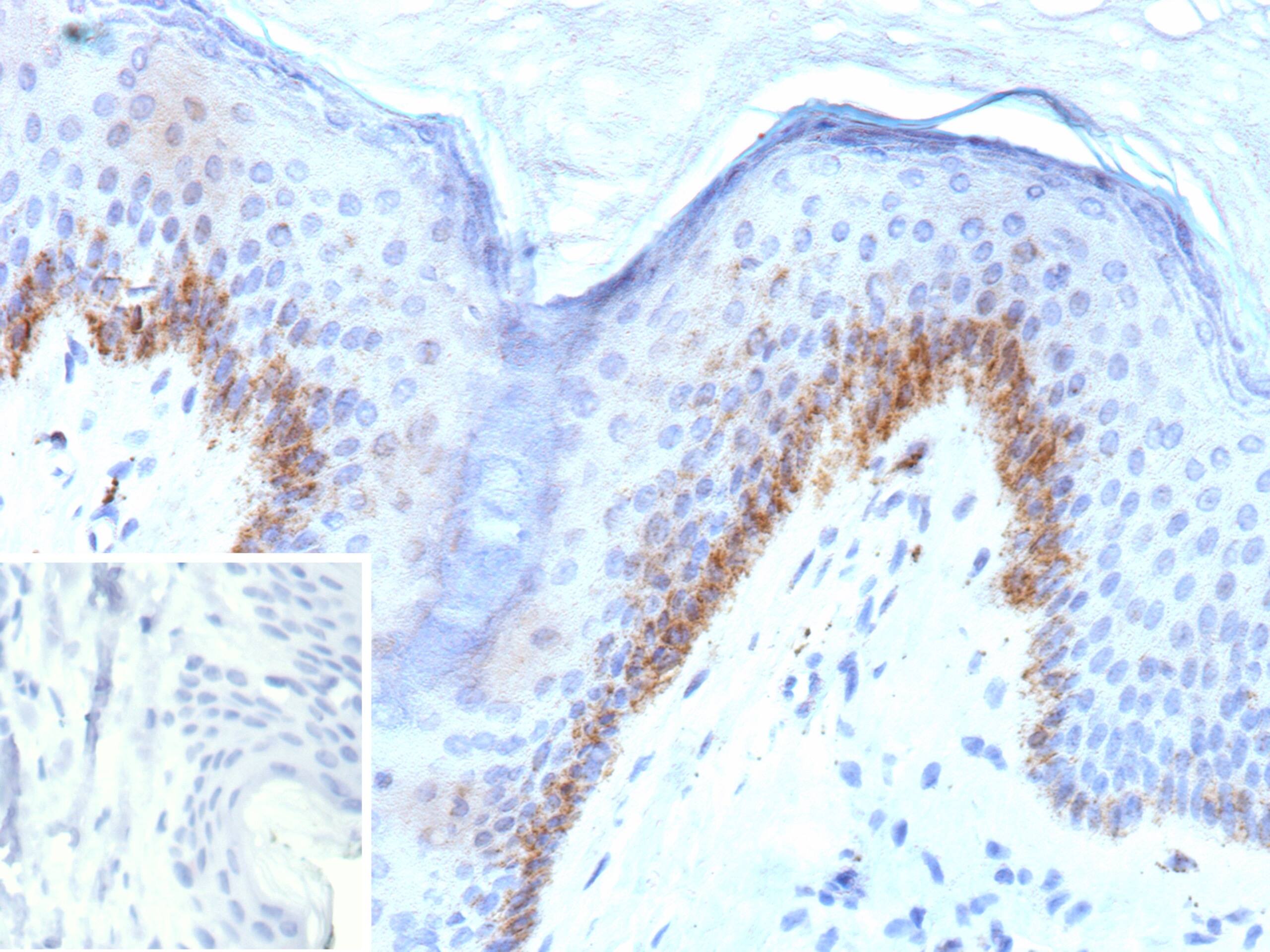 Formalin-fixed, paraffin-embedded human skin stained with Kallikrein 4/Prostase/EMSP1 Antibody (KLK4/8943) - Azide and BSA Free. Inset: PBS instead of primary antibody; secondary only negative control.