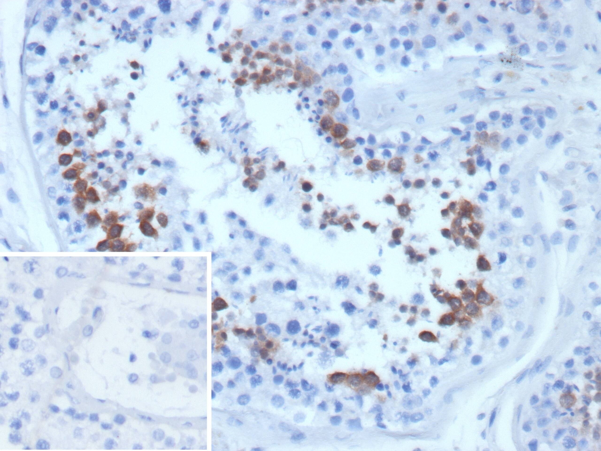 Formalin-fixed, paraffin-embedded human testis stained with Centrin 1 Antibody (CETN1/9877) - Azide and BSA Free. Inset: PBS instead of primary antibody; secondary only negative control.