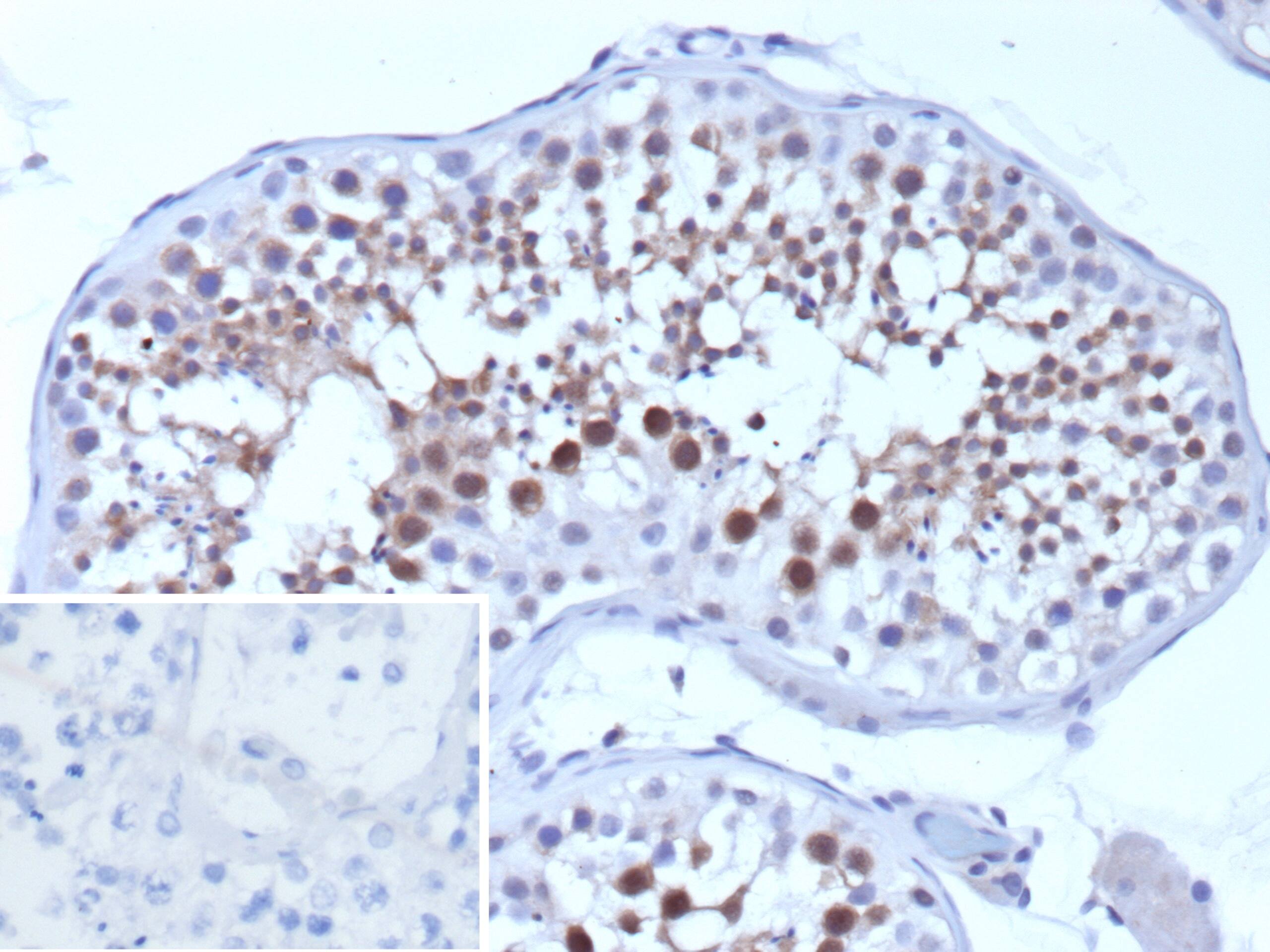 Formalin-fixed, paraffin-embedded human testis stained with SMN Antibody (SMN1/1596) - Azide and BSA Free.Inset: PBS instead of primary antibody; secondary only negative control.