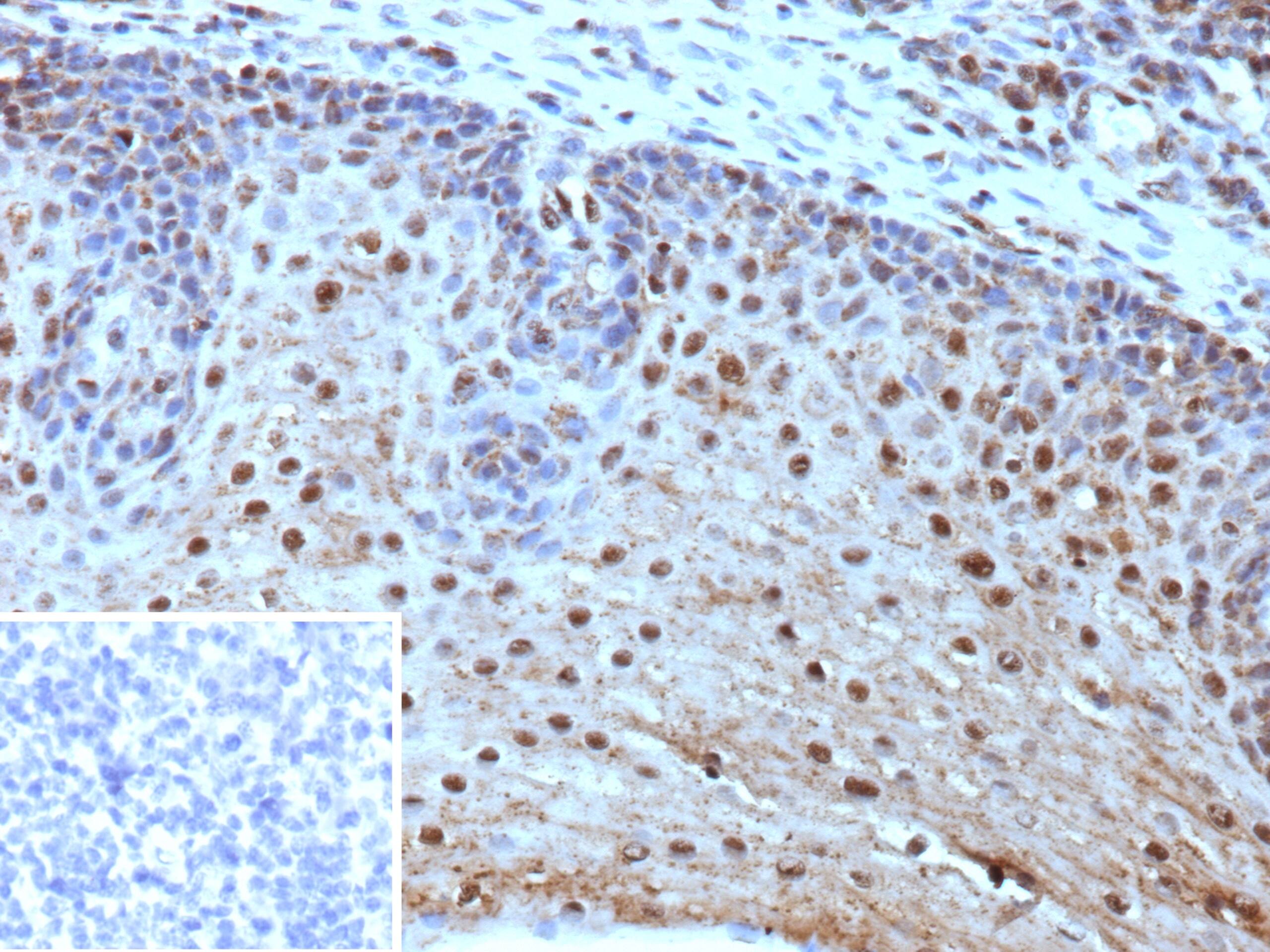 Formalin-fixed, paraffin-embedded human tonsil stained with HLA-E Antibody (HLAE/9468) - Azide and BSA Free). Inset: PBS instead of primary antibody; secondary only negative control.