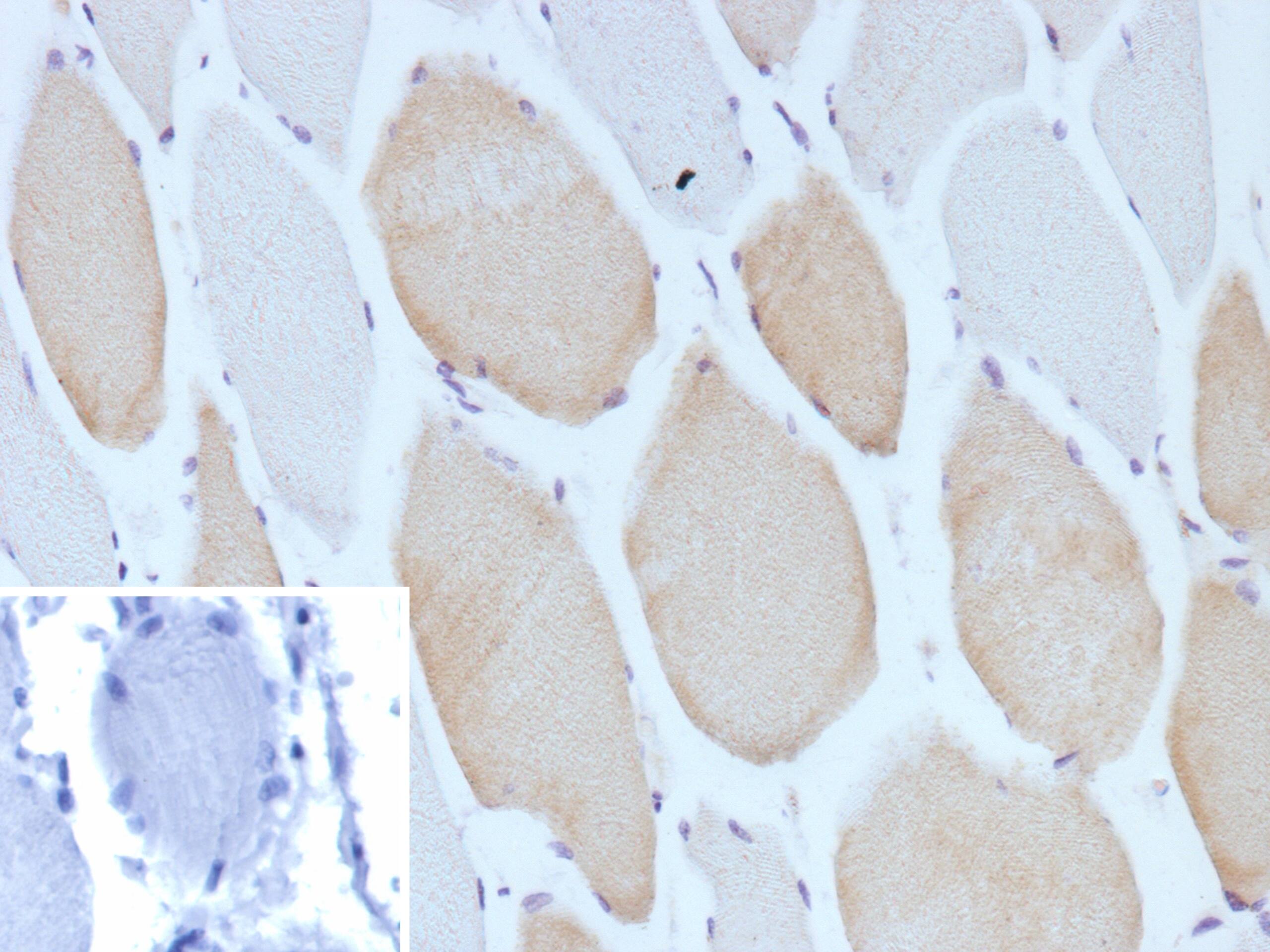 Formalin-fixed, paraffin-embedded human skeletal muscle stained with MYH7 Antibody (MYH7/13050R) - Azide and BSA Free. Inset: PBS instead of primary antibody; secondary only negative control.