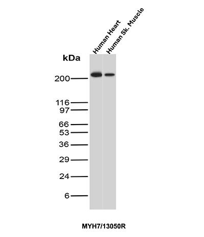 Western Blot Analysis of human heart and human skeletal muscle tissue lysates using MYH7 Antibody (MYH7/13050R) - Azide and BSA Free.