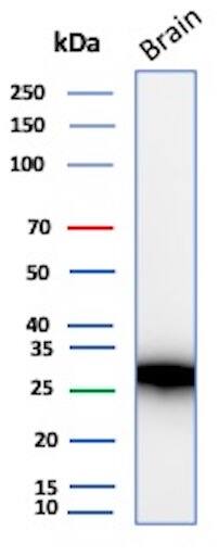 Western blot analysis of human brain tissue lysate using Calbindin D-28K Antibody (rCALB1/13280) - Azide and BSA Free.