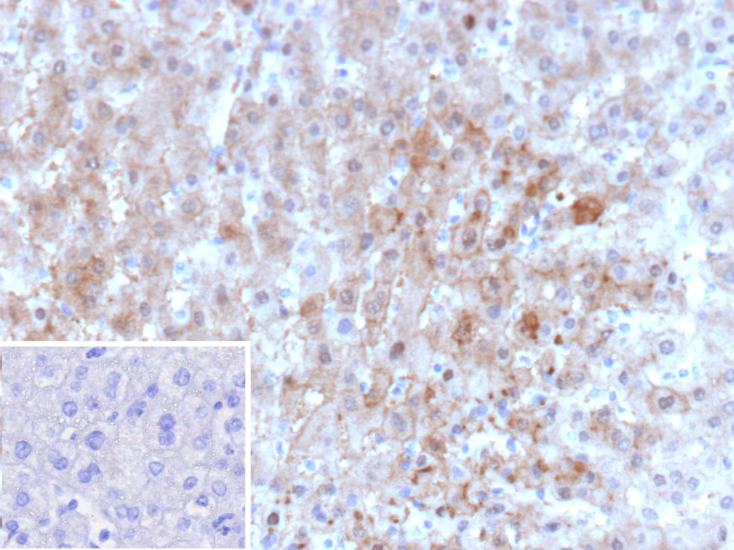 Formalin-fixed, paraffin-embedded human liver stained with Aldo-keto Reductase 1C1/AKR1C1 Antibody (AKR1C1/9062) - Azide and BSA Free. Inset: PBS instead of primary antibody; secondary only negative control.