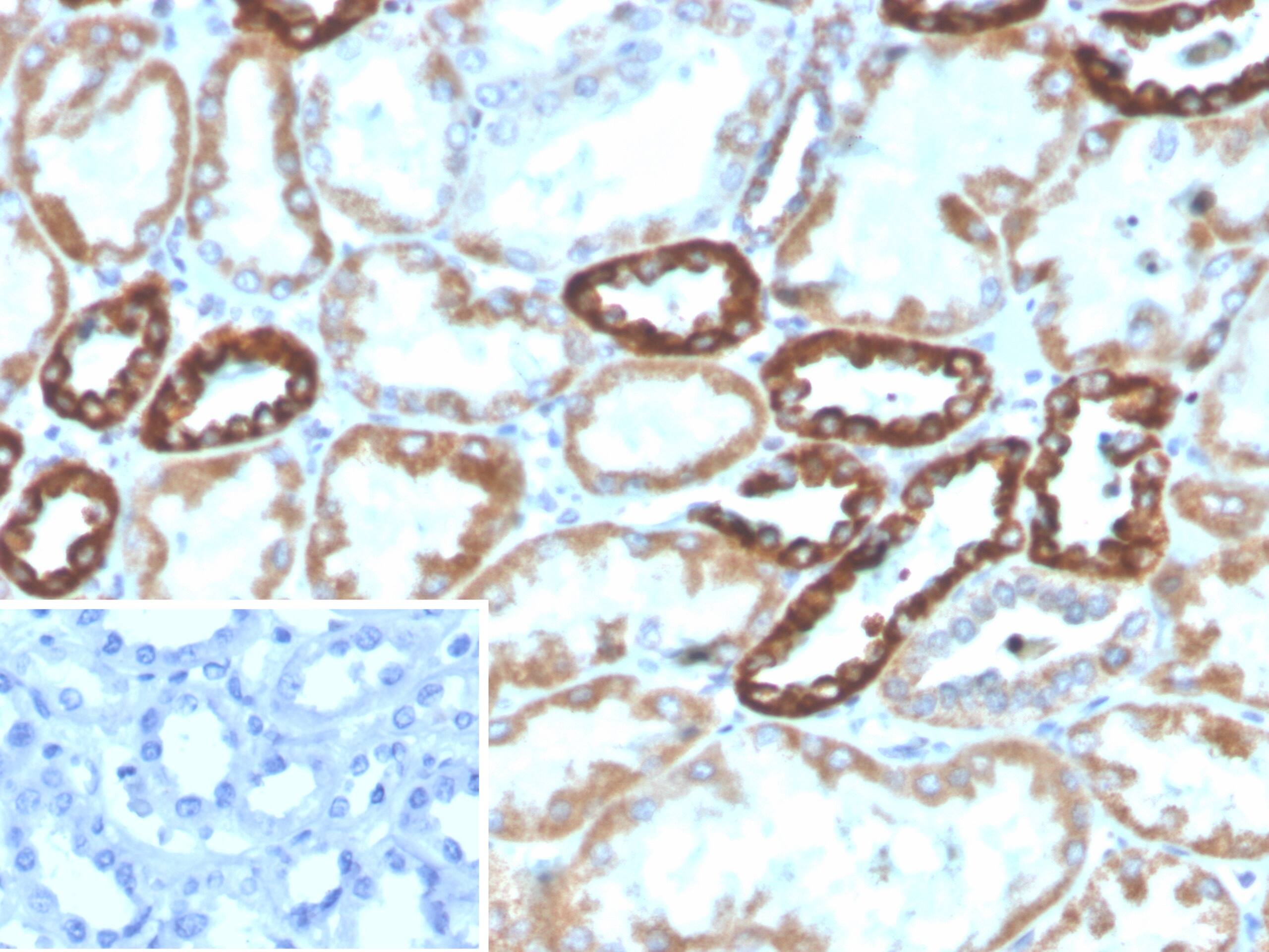 Formalin-fixed, paraffin-embedded human kidney stained with PLA2R1 Antibody (PLA2R1/4891) - Azide and BSA Free. Inset: PBS instead of primary antibody; secondary only negative control.