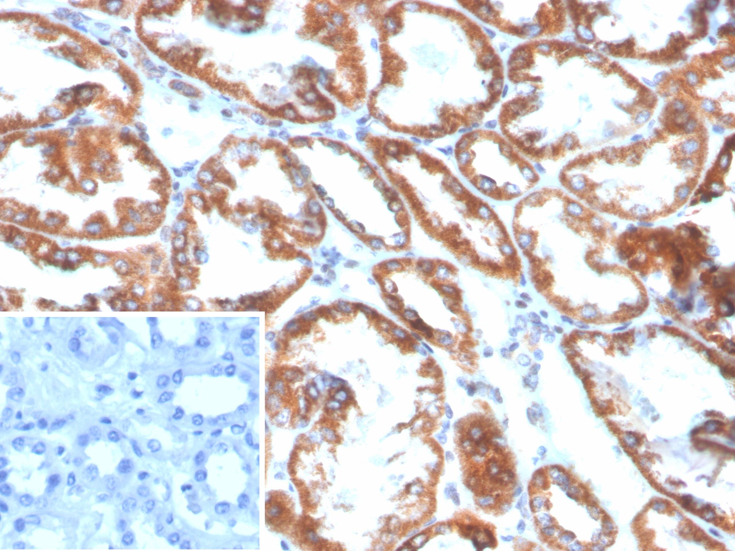 Formalin-fixed, paraffin-embedded human kidney stained with PLA2R1 Antibody (PLA2R1/4898) - Azide and BSA Free. Inset: PBS instead of primary antibody; secondary only negative control.