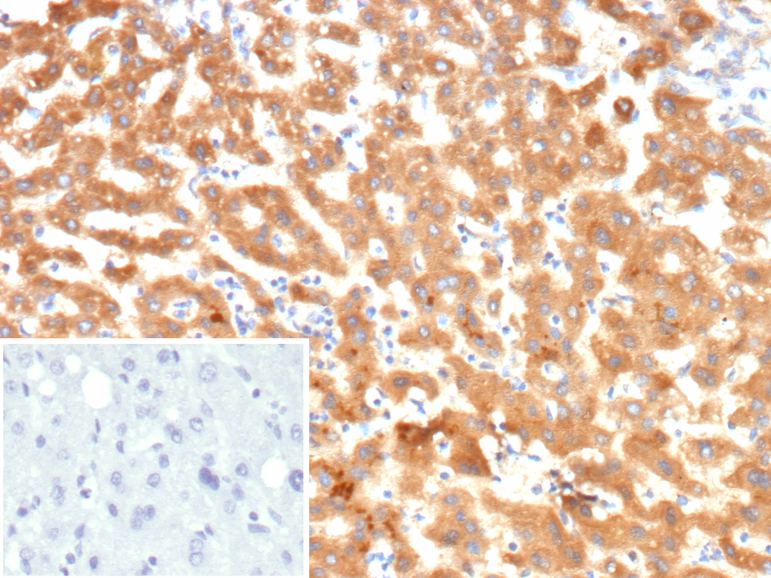 Formalin-fixed, paraffin-embedded human liver stained with Kininogen 1 Antibody (KNG1/7422) - Azide and BSA Free. Inset: PBS instead of primary antibody; secondary only negative control.