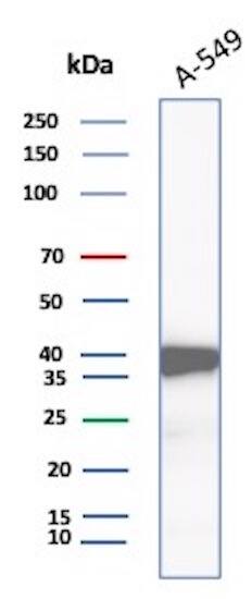 Western Blot Analysis of A-549 lysate using Aldo-keto Reductase 1C1/AKR1C1 Antibody (AKR1C1/9318) - Azide and BSA Free.