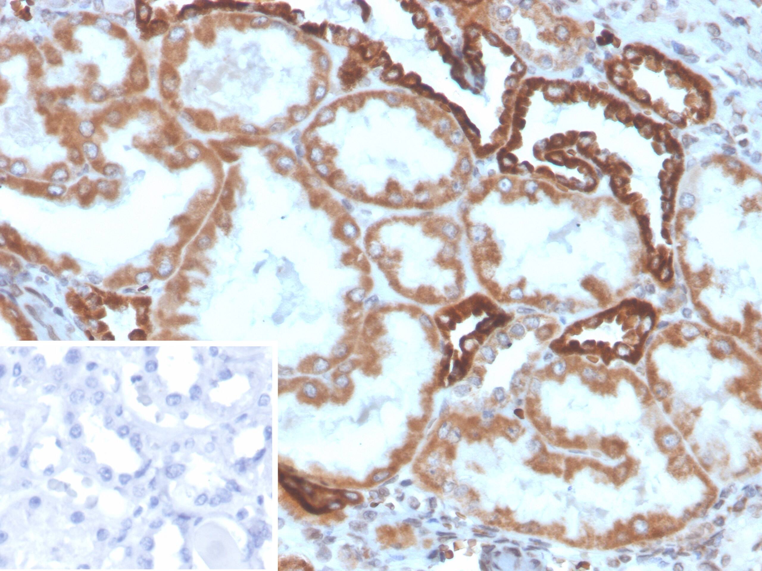 Formalin-fixed, paraffin-embedded human kidney stained with PLA2R1 Antibody (PLA2R1/4896) - Azide and BSA Free. Inset: PBS instead of primary antibody; secondary only negative control.