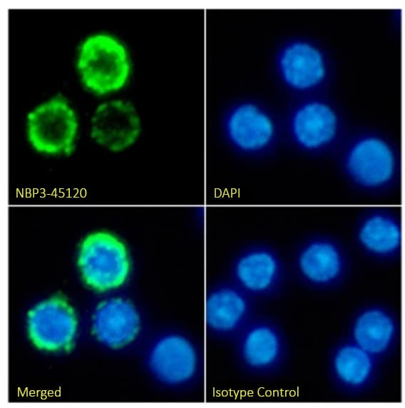 Immunocytochemistry/ Immunofluorescence: MHC Class II Antibody (A6-61.3) - BSA Free [NBP3-45120] - Immunofluorescence analysis of paraformaldehyde fixed mouse splenocytes on coverslips stained with NBP3-45120 at 10 µg/ml for 1h followed by Alexa Fluor® 488 secondary antibody (2 µg/ml), showing membrane staining. The nuclear stain is DAPI (blue). Panels show from left-right, top-bottom NBP3-45120, DAPI, merged channels and an isotype control. The isotype control was an unknown specificity antibody followed by staining with Alexa Fluor® 488 secondary antibody.