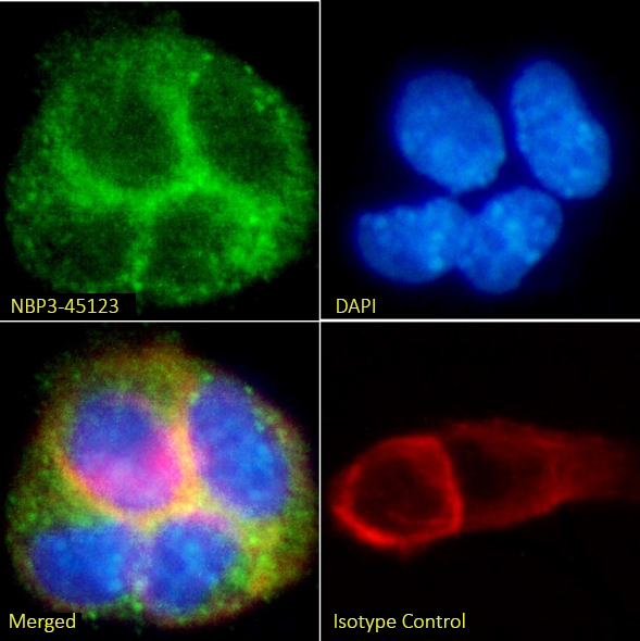 Immunocytochemistry/ Immunofluorescence: 5T4 Antibody (39A11G5F2) - Chimeric - BSA Free [NBP3-45123] - Immunofluorescence analysis of paraformaldehyde-fixed A431 cells on coverslips stained with NBP3-45123 (1:100 dilution) for 1h followed by Alexa Fluor® 488 secondary antibody (1:1000 dilution), showing cytoplasmic, membrane, and vesicles staining. The nuclear stain is DAPI (blue). Panels show, from left-right, top-bottom, NBP3-45123, DAPI, merged channels, and an isotype control. The isotype control was an unknown specificity antibody followed by staining with Alexa Fluor® 488 secondary antibody.
