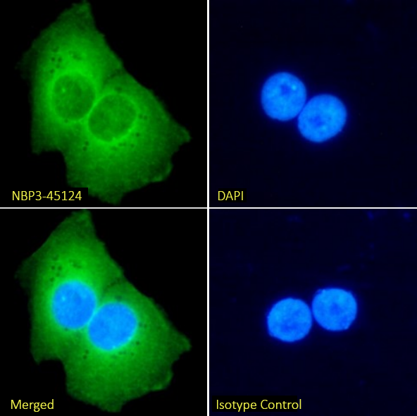 Immunocytochemistry/ Immunofluorescence: EpCAM/TROP1 Antibody (MT201 (HD69)) - Chimeric, (Research Grade adecatumumab Biosimilar) - BSA Free [NBP3-45124] - Immunofluorescence analysis of paraformaldehyde-fixed A431 cells on coverslips stained with NBP3-45124 (1:100 dilution) for 1h followed by Alexa Fluor® 488 secondary antibody (1:1000 dilution), showing cytoplasmic and membrane staining. The nuclear stain is DAPI (blue). Panels show, from left-right, top-bottom, NBP3-45124, DAPI, merged channels and an isotype control. The isotype control was an unknown specificity antibody followed by staining with Alexa Fluor® 488 secondary antibody.