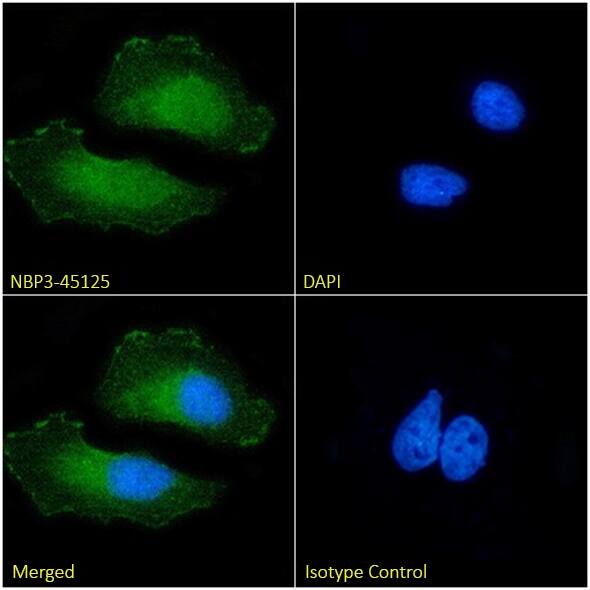 Immunocytochemistry/ Immunofluorescence: p16INK4a/CDKN2A Antibody (30859-S17) - Chimeric - BSA Free [NBP3-45125] - Immunofluorescence analysis of paraformaldehyde-fixed HeLa cells, permeabilized with 0.15% Triton, on coverslips stained with NBP3-45125 (1:100 dilution) for 1h followed by Alexa Fluor® 488 secondary antibody (1:1000 dilution), showing nuclear and cytoplasmic staining. The nuclear stain is DAPI (blue). Panels show, from left-right, top-bottom, NBP3-45125, DAPI, merged channels, and an isotype control. The isotype control was an unknown specificity antibody followed by staining with Alexa Fluor® 488 secondary antibody.
