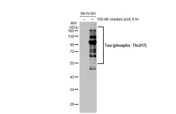Western Blot: Rabbit Tau [p Thr217] mAb (HL1276) - Untreated (–) and treated (+) SK-N-SH whole cell extracts (30 ug) were separated by 10% SDS-PAGE, and the membrane was blotted with Tau (p Thr217) antibody [HL1276] diluted at 1:1000. The HRP-conjugated anti-rabbit IgG antibody was used to detect the primary antibody.