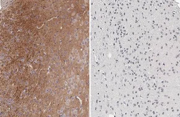 Immunohistochemistry: Rabbit Tau [p Thr181] mAb (HL2497) [NBP3-45157] - Tau (p Thr181) antibody [HL2497] detects Tau (p Thr181) protein at cytoplasm by immunohistochemical analysis in the presence of control peptide (left) or antigen-specific peptide (right).Sample: Paraffin-embedded mouse brain.Tau (p Thr181) stained by Tau (p Thr181) antibody [HL2497] (GTX638855) diluted at 1:100.