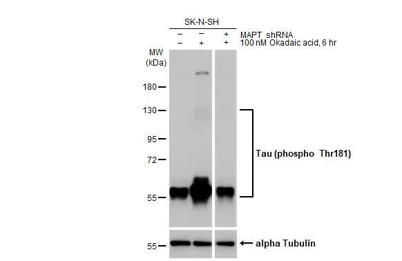 Western Blot: Rabbit Tau [p Thr181] mAb (HL2497) [NBP3-45157] - Untreated (–) and treated (+) SK-N-SH whole cell extracts (30 μg) were separated by 7.5% SDS-PAGE, and the membrane was blotted with Tau (p Thr181) antibody [HL2497] diluted at 1:1000. The HRP-conjugated anti-rabbit IgG antibody was used to detect the primary antibody, and the signal was developed with Trident ECL plus-Enhanced.