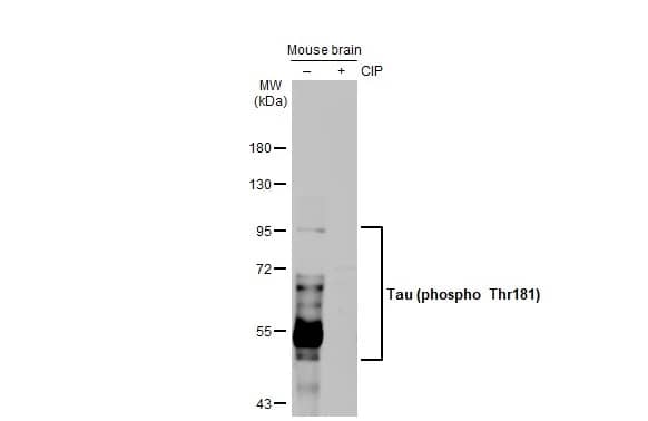 <b>Biological Strategies Validation and Genetic Strategies Validation.</b>Western Blot: Rabbit Tau [p Thr181] mAb (HL2497) [NBP3-45157] - Untreated (–) and treated (+) mouse tissue extract (50 ug) were separated by 7.5% SDS-PAGE, and the membrane was blotted with Tau (phospho Thr181) antibody [HL2497] (GTX638855) diluted at 1:1000. The HRP-conjugated anti-rabbit IgG antibody was used to detect the primary antibody.