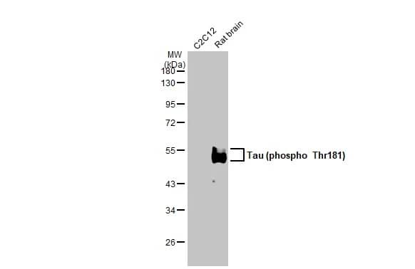 Western Blot: Rabbit Tau [p Thr181] mAb (HL2497) [NBP3-45157] - Whole cell and rat tissue extracts were separated by 10% SDS-PAGE, and the membrane was blotted with Tau (p Thr181) antibody [HL2497] diluted at 1:1000. The HRP-conjugated anti-rabbit IgG antibody was used to detect the primary antibody, and the signal was developed with Trident ECL plus-Enhanced.