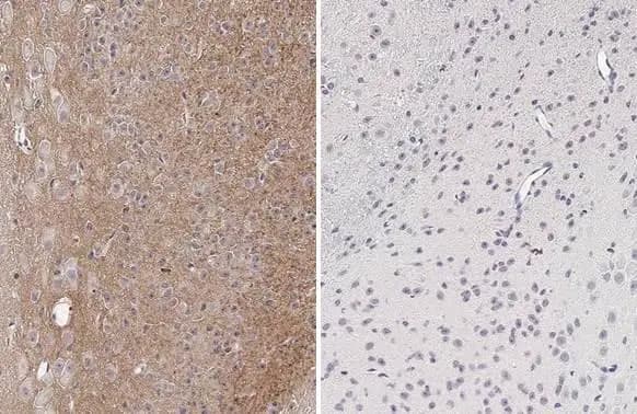 Immunohistochemistry: Rabbit Tau [p Thr181] mAb (HL2498) [NBP3-45158] - Tau (p Thr181) antibody [HL2498] detects Tau (phospho Thr181) protein in the cytoplasm by immunohistochemical analysis in the presence of non phospho control peptide (left) but not in the presence of the antigenic phospho peptide (right).Sample: Paraffin-embedded mouse brain.Tau (p Thr181) stained by Tau (p Thr181) antibody [HL2498] diluted at 1:100.