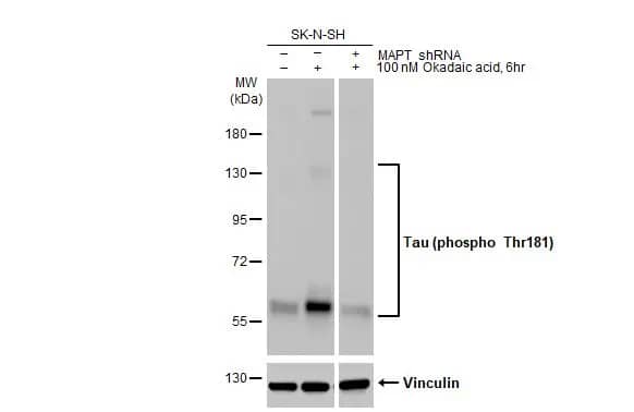 Western Blot: Rabbit Tau [p Thr181] mAb (HL2498) [NBP3-45158] - Untreated (–) and treated (+) SK-N-SH whole cell extracts (30 ug) were separated by 7.5% SDS-PAGE, and the membrane was blotted with Tau (p Thr181) antibody [HL2498] diluted at 1:1000. The HRP-conjugated anti-rabbit IgG antibody was used to detect the primary antibody.