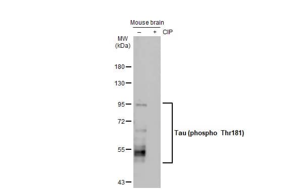 <b>Biological Strategies Validation and Genetic Strategies Validation.</b>Western Blot: Rabbit Tau [p Thr181] mAb (HL2498) [NBP3-45158] - Untreated (–) and treated (+) Mouse tissue extract (50 ug) were separated by 7.5% SDS-PAGE, and the membrane was blotted with Tau (p Thr181) antibody [HL2498] diluted at 1:1000. The HRP-conjugated anti-rabbit IgG antibody was used to detect the primary antibody.