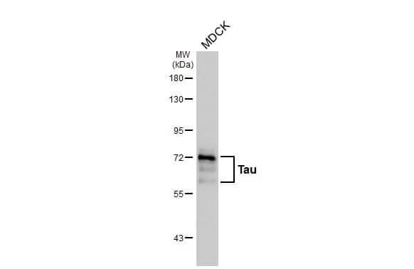 Western Blot: Rabbit Tau mAb (HL2982) [NBP3-45159] - Whole cell extract (30 μg) was separated by 7.5% SDS-PAGE, and the membrane was blotted with Tau antibody [HL2982] diluted at 1:1000. The HRP-conjugated anti-rabbit IgG antibody was used to detect the primary antibody.