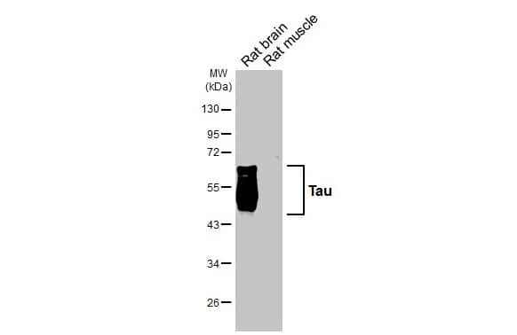 Western Blot: Rabbit Tau mAb (HL2982) [NBP3-45159] - Various tissue extracts (50 μg) were separated by 10% SDS-PAGE, and the membrane was blotted with Tau antibody [HL2982] diluted at 1:1000. The HRP-conjugated anti-rabbit IgG antibody was used to detect the primary antibody.