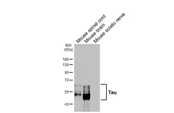 Western Blot: Rabbit Tau mAb (HL2982) - Various tissue extracts (50 μg) were separated by 10% SDS-PAGE, and the membrane was blotted with Tau antibody [HL2982] diluted at 1:1000. The HRP-conjugated anti-rabbit IgG antibody was used to detect the primary antibody.